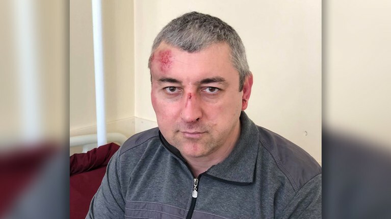 В адрес сотрудников правозащитного центра ранее уже поступали угрозы