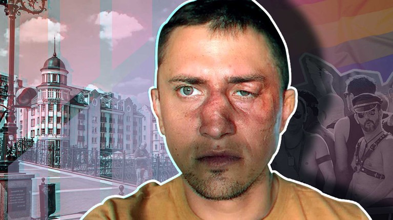 «Подрался за бабушку в гей-клубе»: Прилучный о драке в Калининграде — Daily Storm