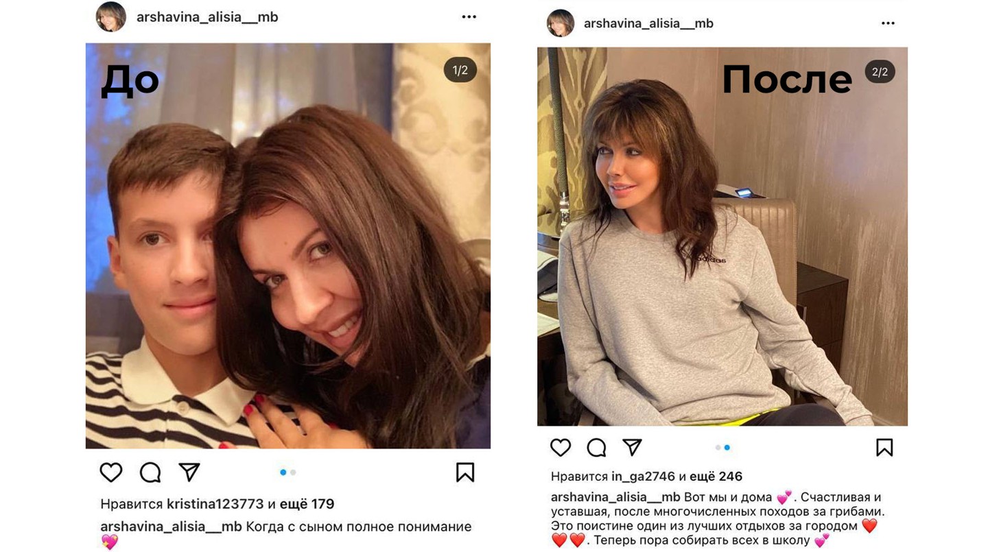 Скрин носа - До и После